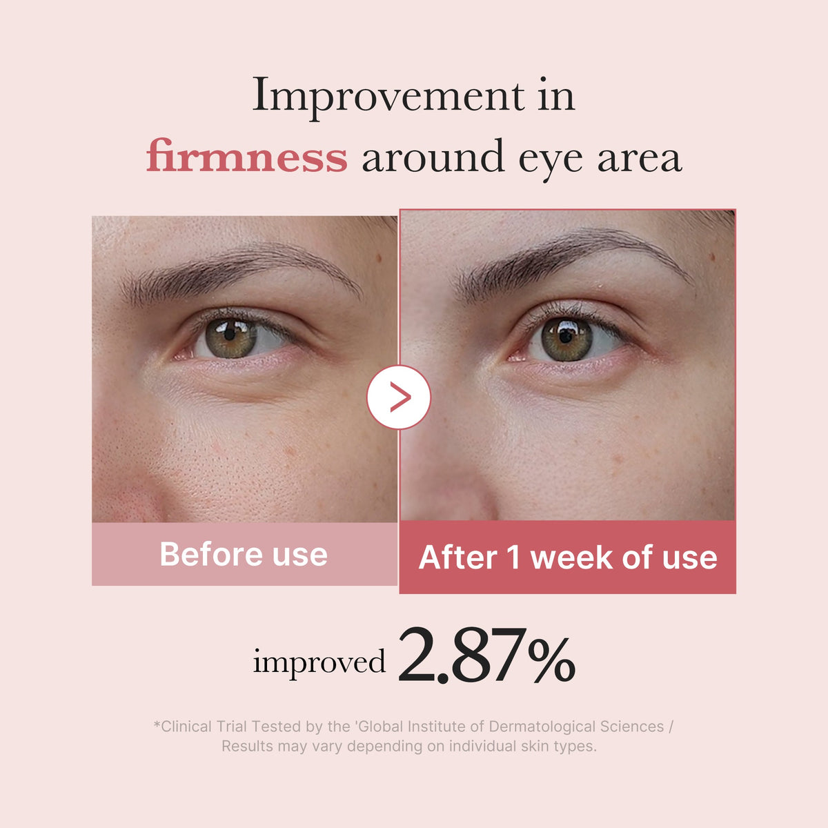 PDRN Pink Peptide Eye Cream