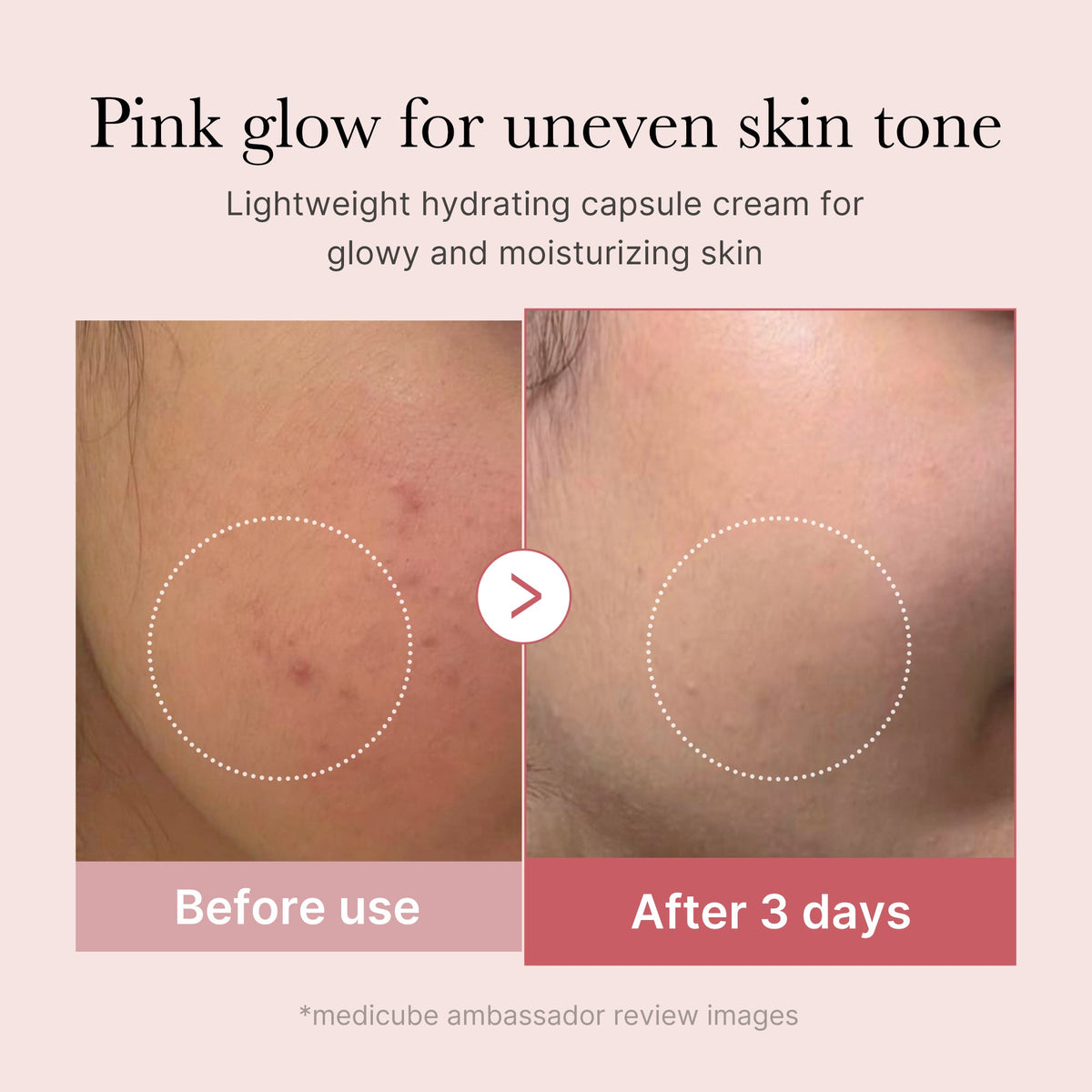 No.1 Best Glass Glow Set Pink